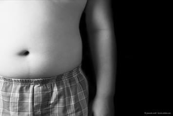 obesity guidelines