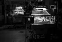 Extreme Prematurity